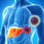 Под ударом – печень